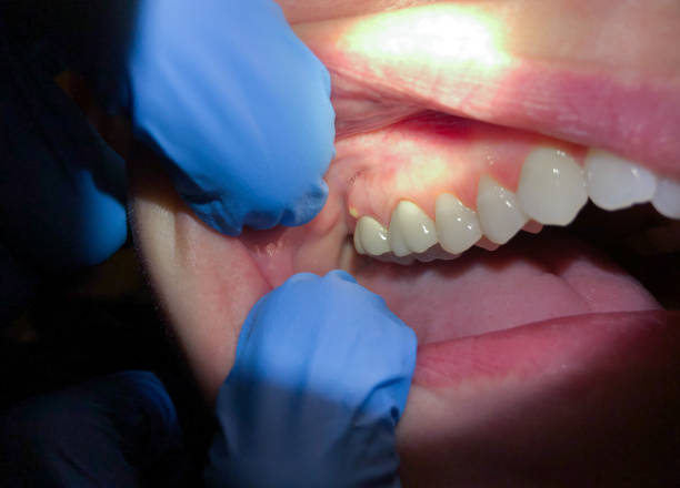 Best Orthodontic Emergency Dentist in Oxford, NC