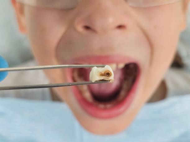 Best Pediatric Emergency Dentist in Oxford, NC